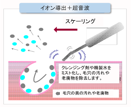 超音波クレンジング