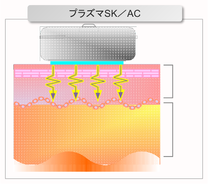 プラズマSK/AC
