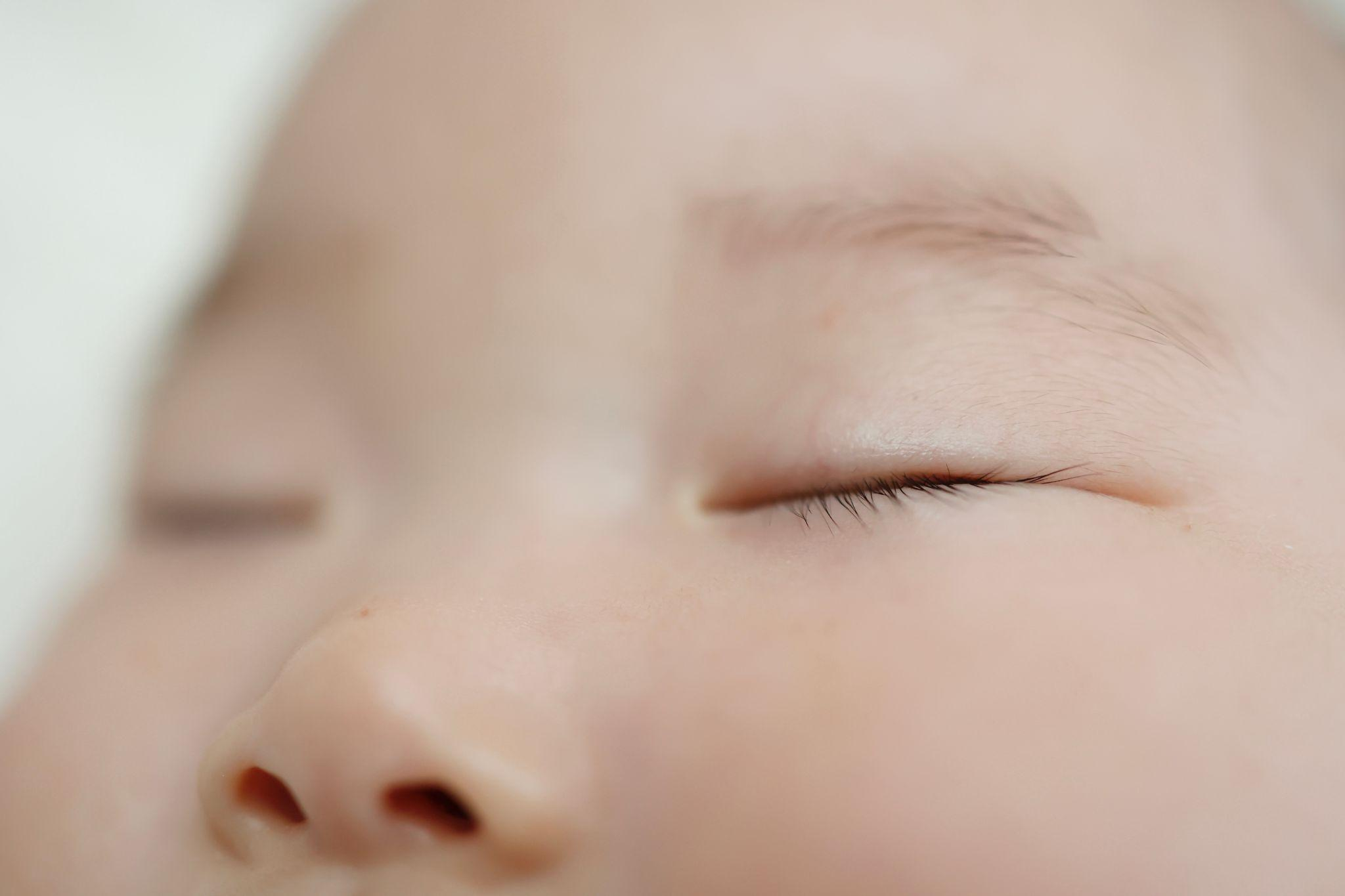 子どもの眼瞼下垂とは