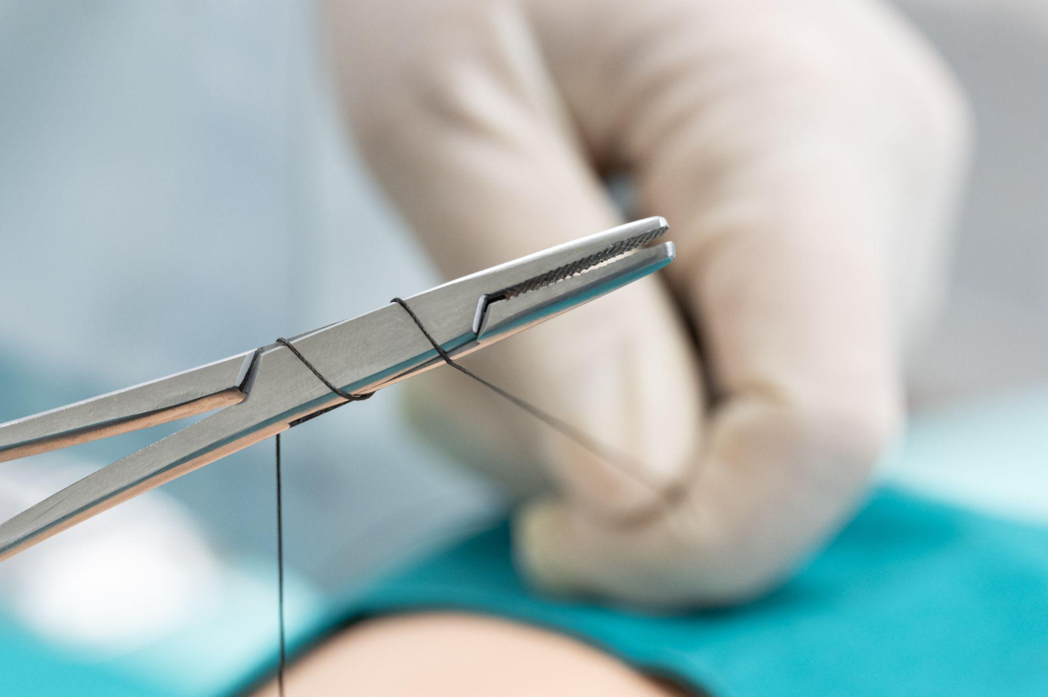 切らない眼瞼下垂治療とは