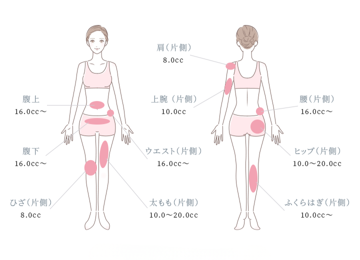 脂肪溶解注射の対象部位と注入量の目安