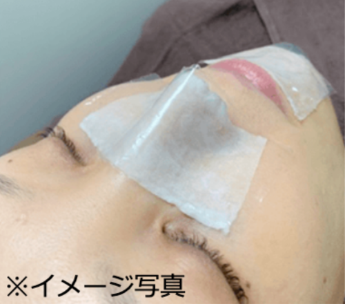 すべての患者様に角栓軟化剤を使用