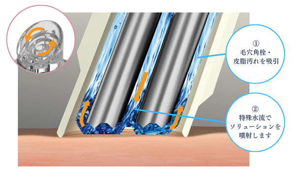 独自の「らせん型チップ」
