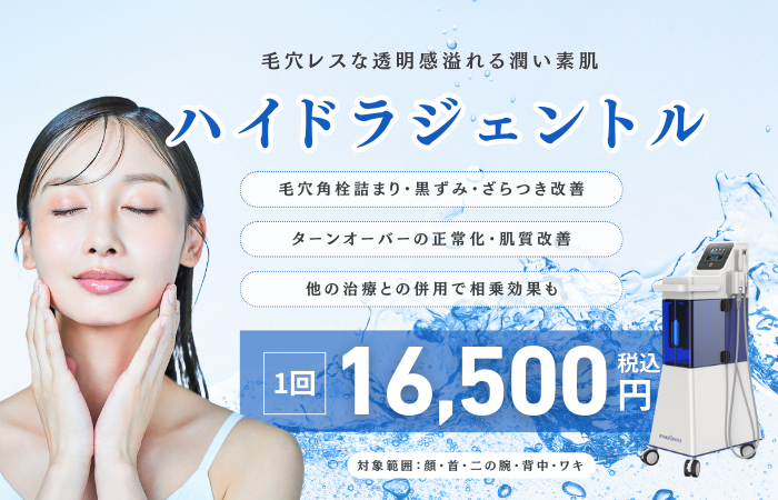 ハイドラジェントルバナー