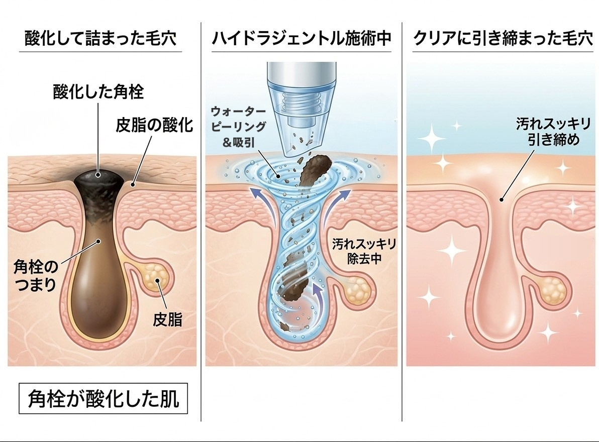 ハイドラジェントルの効果